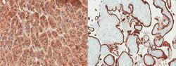 HSD3B1, Mouse anti-Human, Clone: 4C1, Millipore Sigma 100&mu;g; Unconjugated:Antibodies,